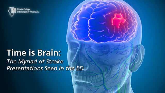 Time is Brain: The Myriad of Stroke Presentations Seen in the ED Course ...